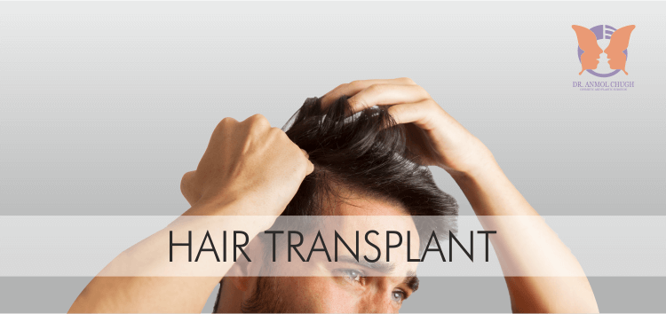 Hair Transplant