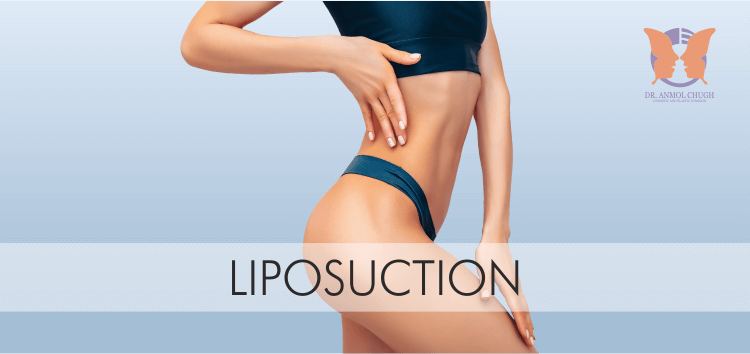 LIPOSUCTION