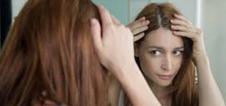 Hair loss in Women Causes & Treatment