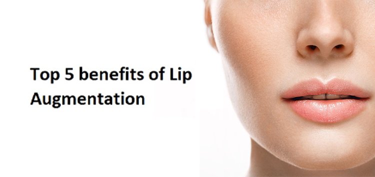 Top 5 benefits of Lip Augmentation