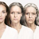 Fat Grafting Vs Fillers The best option for your face