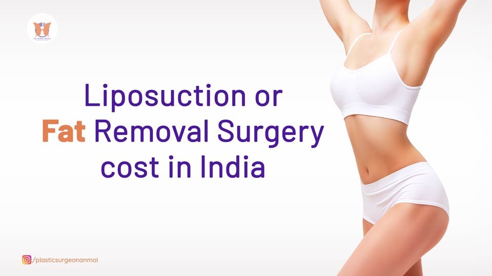 Liposuction Surgery In Gurgaon Belly Fat Removal Surgery Cost In India 