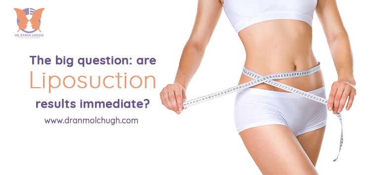 Long Wear Compression Garment Liposuction