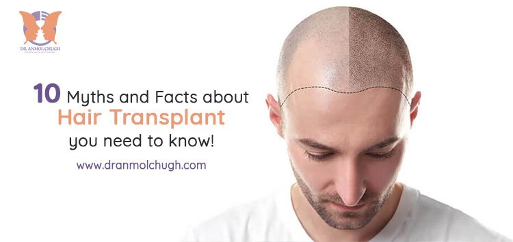 What Is A Hair Transplant  Treatment Rooms London