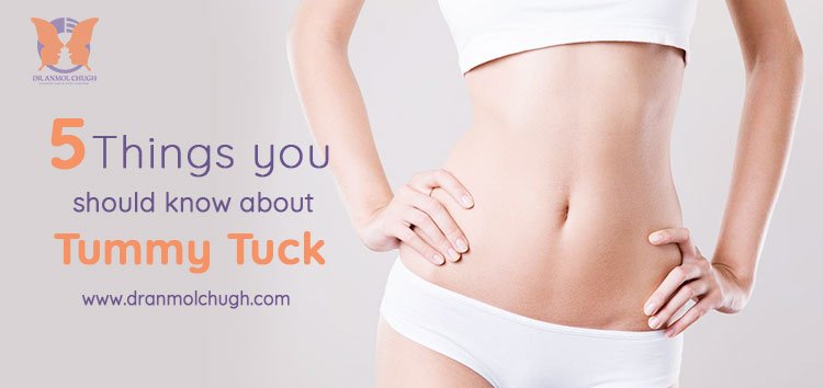 Tummy TUCK Surgery in Gurgaon