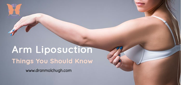 Arm Liposuction