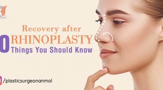 Recovery after Rhinoplasty: 10 things you should to know