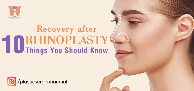 Recovery after Rhinoplasty: 10 things you should to know