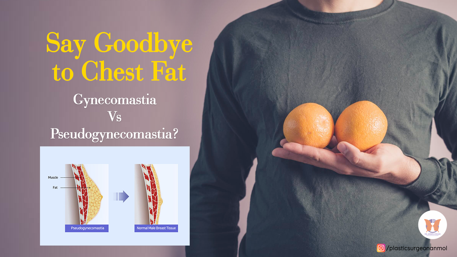 Say Goodbye to Chest Fat!!! Gynecomastia Vs Pseudogynecomastia