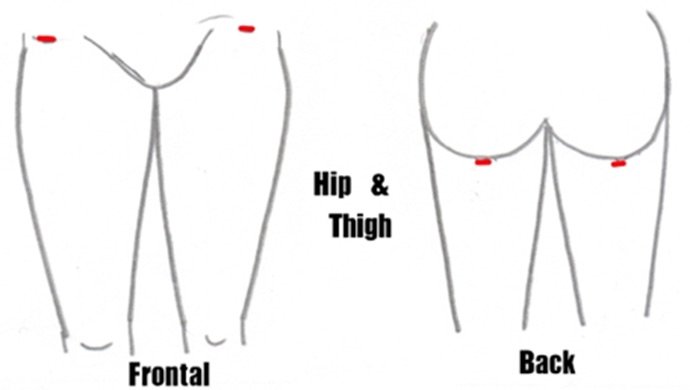 Hip & Thigh Liposuction