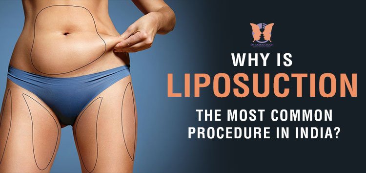 Why is liposuction the most common procedure in India