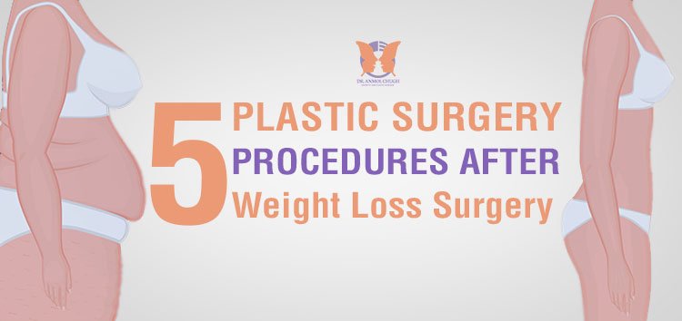 Plastic Surgery Procedures you should consider after Weight Loss Surgery