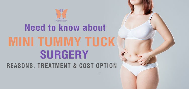 What you need to Know about Mini Tummy Tuck Surgery