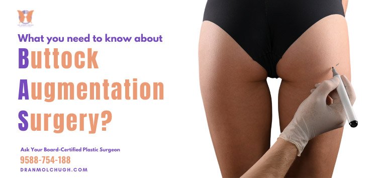 Buttock Augmentation