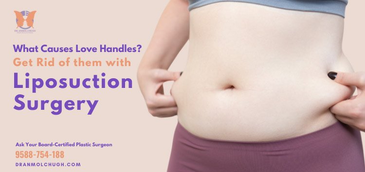 Love Handles, What Causes Love Handles