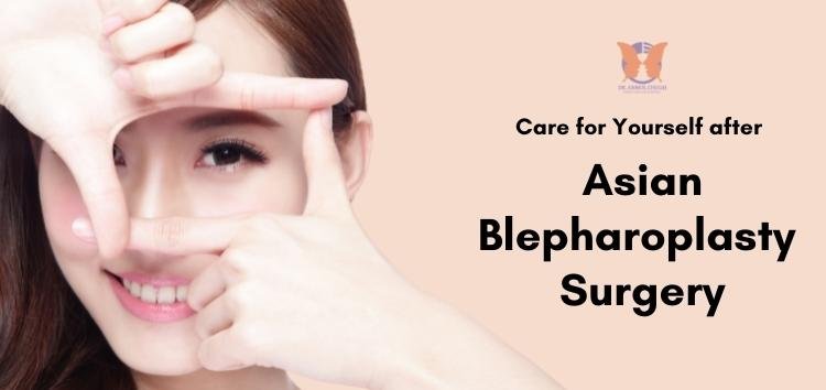 How to Care for Yourself After Your Blepharoplasty or Eyelid Surgery?