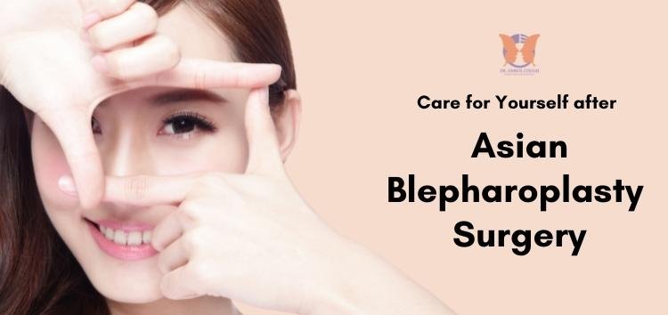 how-to-care-for-yourself-after-your-blepharoplasty-or-eyelid-surgery