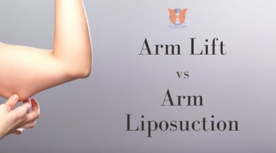 Arm Lift vs Arm Liposuction