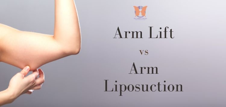 Arm Lift vs Arm Liposuction