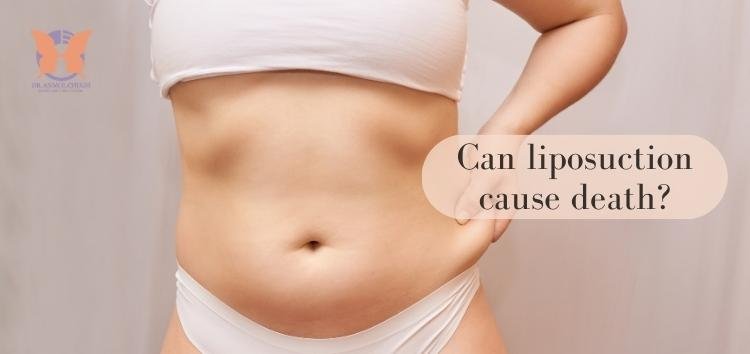 Can liposuction cause death?