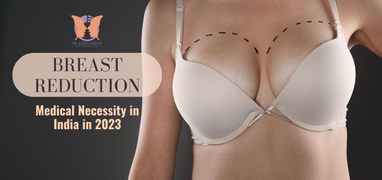 Breast surgery becomes the new rage in India - India Today