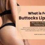 What is Female Buttocks Liposuction