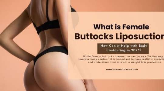 What is Female Buttocks Liposuction