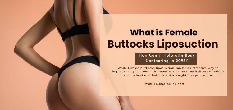 Benefits of Female Buttocks Liposuction Surgery-How Can it Help