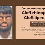 Can cleft rhinoplasty and cleft lip revision help adults and teenagers regain their confidence