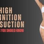High definition Liposuction: 3 key steps you should know before Surgery