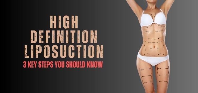 High definition Liposuction: 3 key steps you should know before Surgery