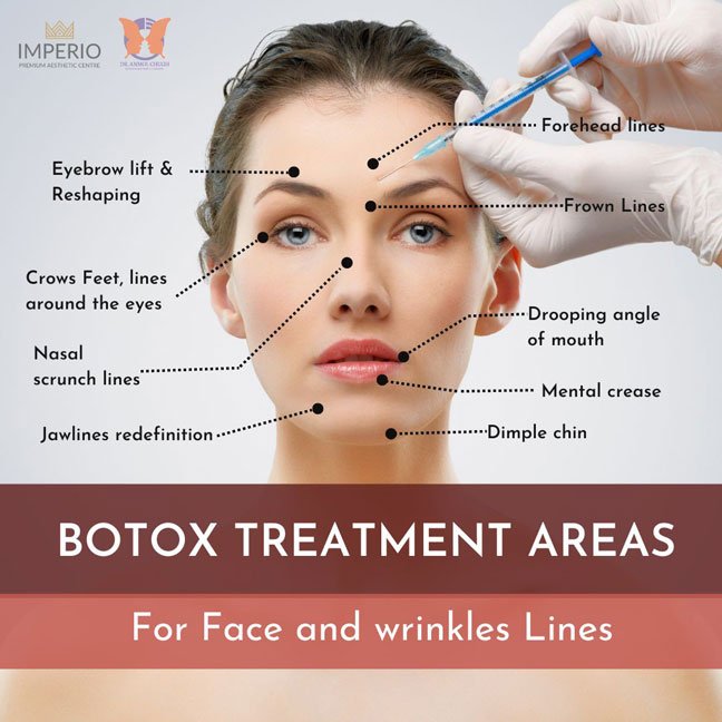 BOTOX TREATMENT AREAS