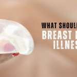 What Should You Know About Breast Implant Illnesses
