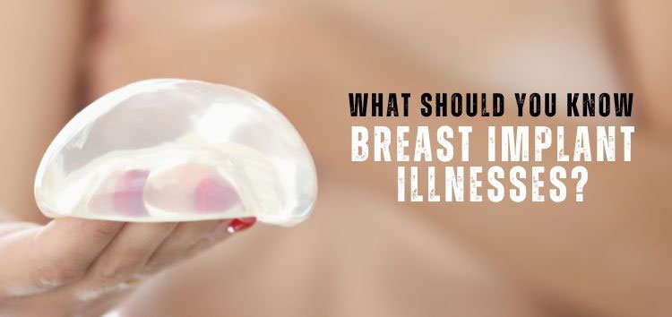 What Should You Know About Breast Implant Illnesses