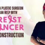 What Kind of Breast Reconstruction is Right for you after Breast Cancer?