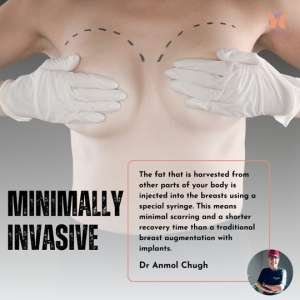 Minimally Invasive Surgery