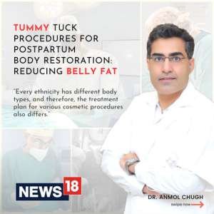Tummy Tuck Procedures for Postpartum Body Restoration: Reducing Belly Fat
