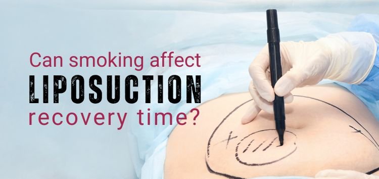 Can smoking affect liposuction recovery time