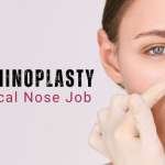 Non-Surgical Nose Job