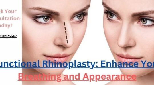 Functional Rhinoplasty Enhance Your Breathing and Appearance