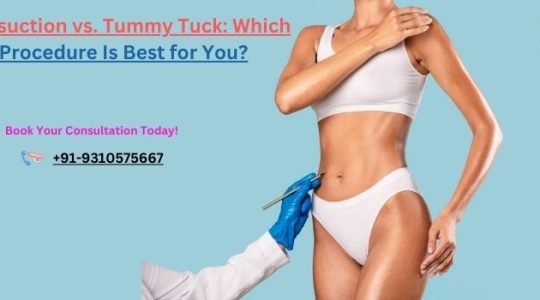 Liposuction vs. Tummy Tuck Which Procedure Is Best for You