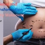 The Emotional and Physical Transformation After a Mommy Makeover