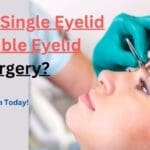 What is a Single Eyelid or Double Eyelid Surgery