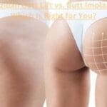 Brazilian Butt Lift vs. Butt Implants