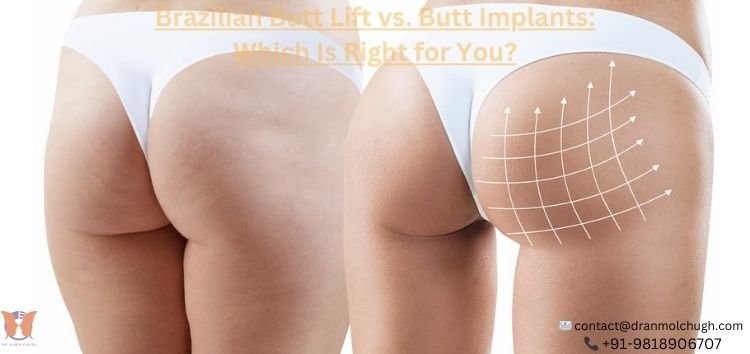 Brazilian Butt Lift vs. Butt Implants