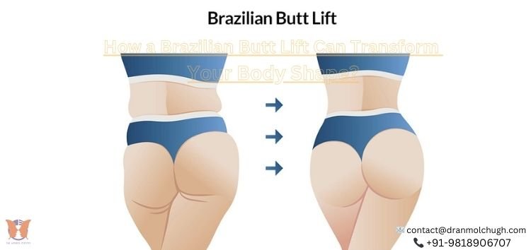 How a Brazilian Butt Lift Can Transform Your Body Shape?