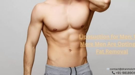 Liposuction for Men: Why More Men Are Opting for Fat Removal