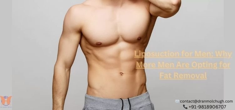 Liposuction for Men: Why More Men Are Opting for Fat Removal