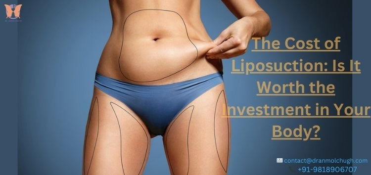 The Cost of Liposuction: Is It Worth the Investment in Your Body?