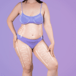 Breakdown of Mommy Makeover costs and price factors